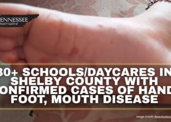 30+ Schools/Daycares In Shelby County With Confirmed Cases of Hand, Foot, Mouth Disease