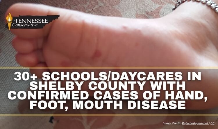 30+ Schools/Daycares In Shelby County With Confirmed Cases of Hand, Foot, Mouth Disease