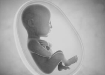 Why we must take a long, hard look at decriminalising abortion