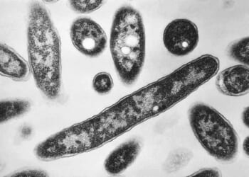 Not Again! Lab-Originated Plague Outbreak in Siberia – HotAir